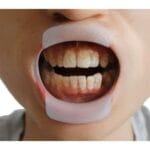 دهان بازکن قدامی سفید رنگ با طراحی انعطافپذیر برای معاینات دندانپزشکی و جراحیهای دهان.