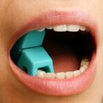 دهان بازکن لقمهای 50 عددی برای استفاده در دندانپزشکی