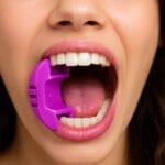 دهان‌بازکن بین‌دندانی سیلیکونی رنگی، ابزار دندانپزشکی برای معاینات دهان