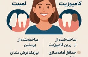 تفاوت لمینت و کامپوزیت