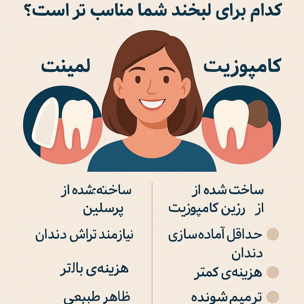 تفاوت لمینت و کامپوزیت